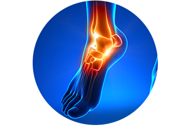 ANKLE